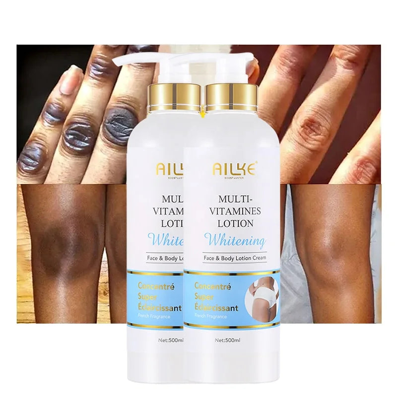 Ailke Milky Niacinamide Knee Elbow  Dark Spot Corrector Women Anti Aging Whitening Body Lotion With Vitamin Secondary image