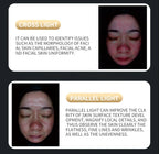 A 3D AI facial skin analyzer for hair diagnosis and professional analysis  with 8-spectrum beauty salon equipment
