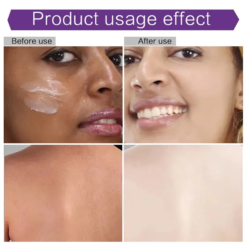 Ailke Gluta Plus Tone up Natural Black Skin Women Face Cream Whitening Body Lotion for Bleaching