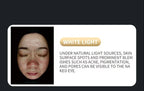 A 3D AI facial skin analyzer for hair diagnosis and professional analysis  with 8-spectrum beauty salon equipment