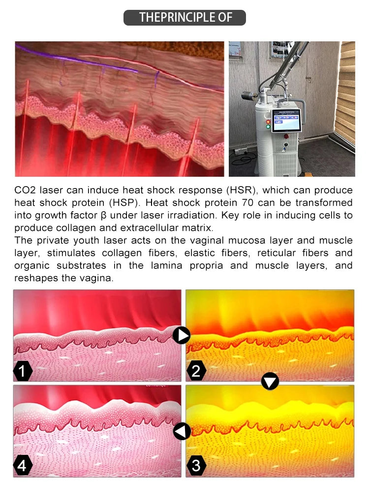 Fractional 4D CO2 Lase Scar Removal Machine 4D Fotona Co2 Fractional lase Machine Skin tightening Wrinkle Remover