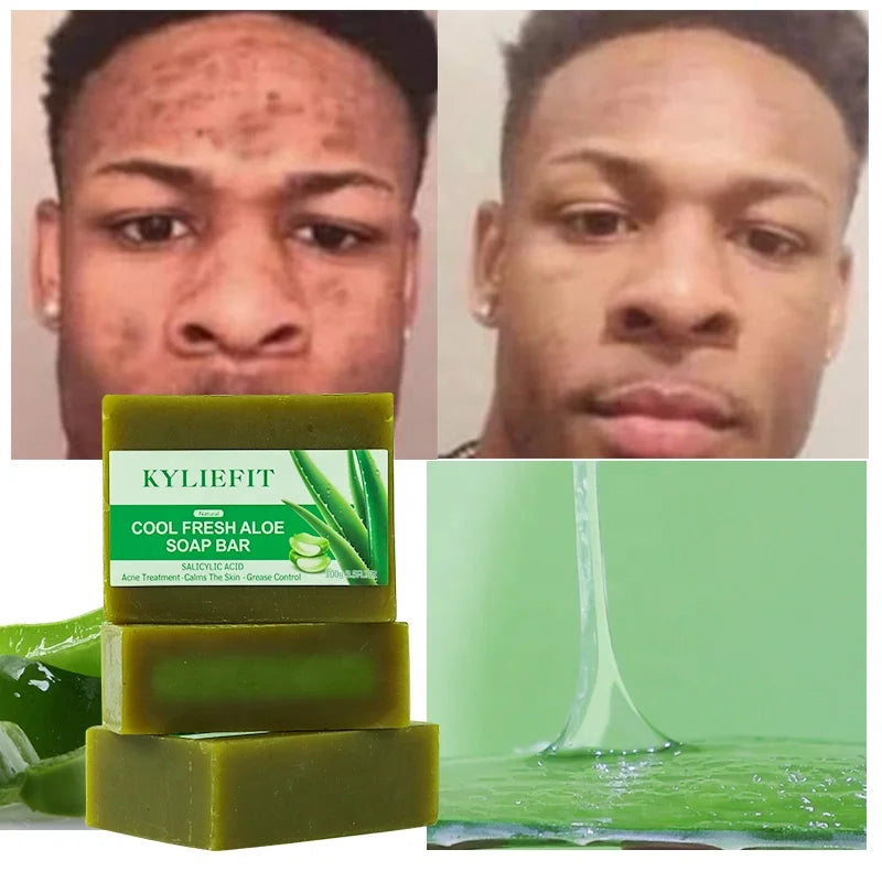 Kyliefit Hand Face Body Soothing Anti Acne Removal Pimples Brightening Lightning Bath Cool Fresh Aloe Vera Soap Bar for All Skin Secondary image