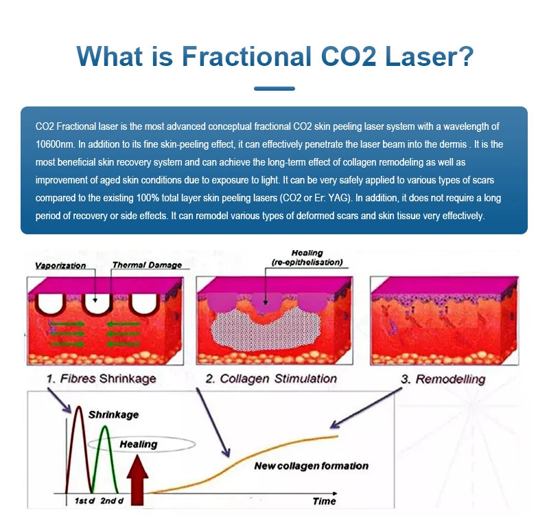 Fractional 4D CO2 Lase Scar Removal Machine 4D Fotona Co2 Fractional lase Machine Skin tightening Wrinkle Remover