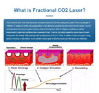 Fractional 4D CO2 Lase Scar Removal Machine 4D Fotona Co2 Fractional lase Machine Skin tightening Wrinkle Remover