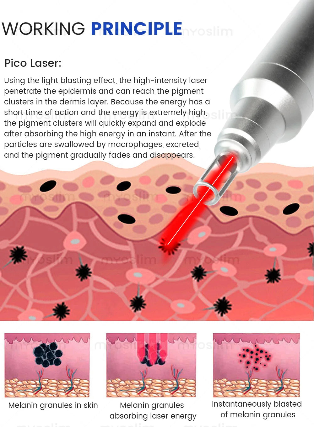 FAC 5000W 2 IN 1 Professional 4 Wave 808 Diode Laser Permanent Painless Hair Removal Picosecond Laser Tattoo Removal Machine