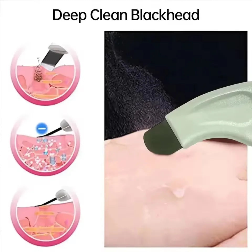 Facial Blackhead Removal Tool Nose Deep Cleansing Remove Whitehead Acne Handheld Beauty Care Tool Secondary image