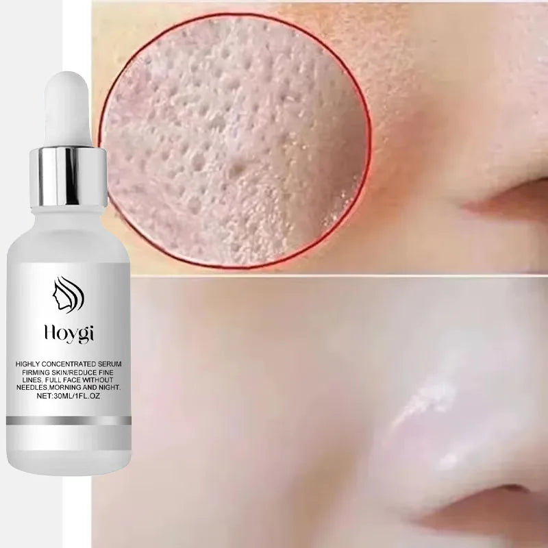 Remove Large Pores Serum Lactic Acid Facial Pore Shrinking Repairing Products Pore Minimizing Firming Smooth Korean Skin Care. Main image