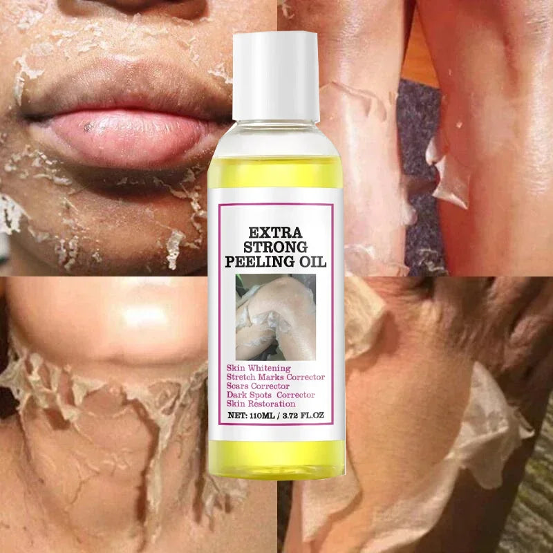 Yellow Peeling Lotion Oil 100% Organic Bleaching Dark Skin Exfoliating Whitening Nourishing Hyaluronic Acid Moisturiz Body Scrub Main image