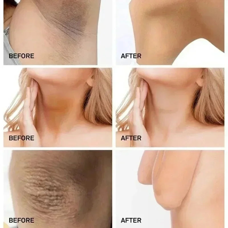 Nicotinamide Brightening Cream For Dark Skin Effective Lighten Thigh Inner Bleach Remove Melanin Private Parts Brighten Cream Secondary image