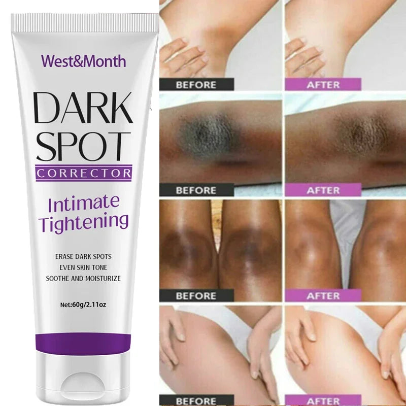 Nicotinamide Brightening Cream For Dark Skin Effective Lighten Thigh Inner Bleach Remove Melanin Private Parts Brighten Cream Main image
