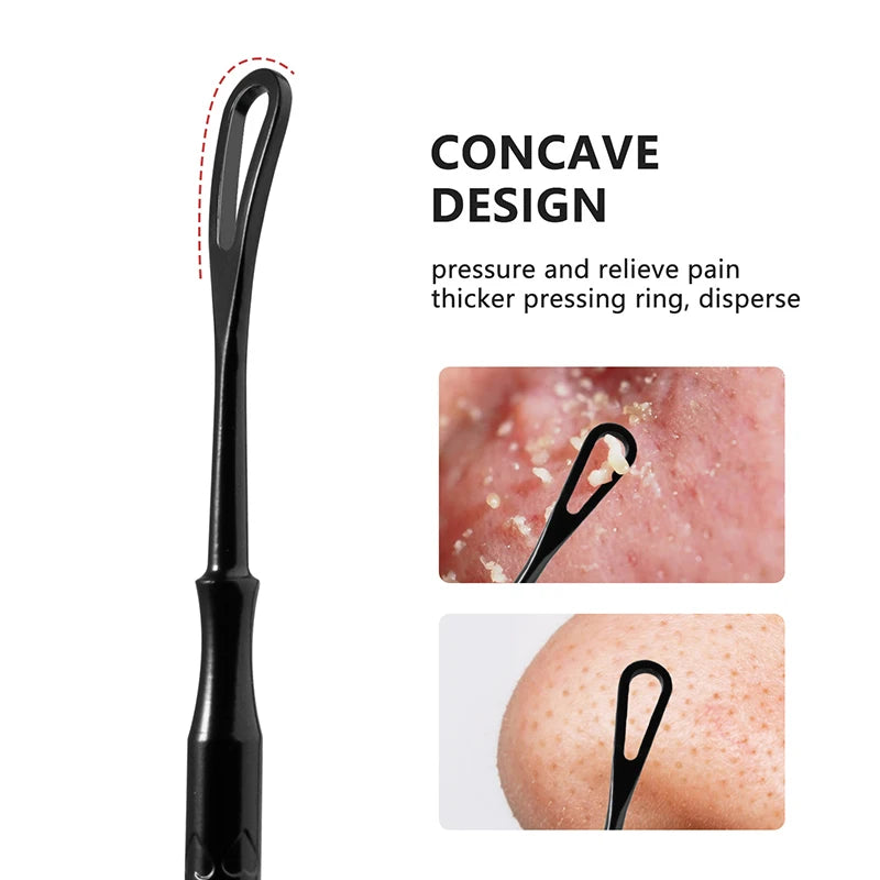 2 In 1 Pimple Popper Tool Blackhead Remover Acne Needle Removing Treatment Whitehead Popping Zit Nose Face Blemish Extractor