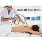 Venus Legacy Body Cellulite Treament Radio Frequency Original Cavitation Slimming Vacuum Roller Facial Firming Fat Burning