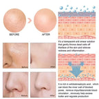 Remove Large Pores Serum Lactic Acid Facial Pore Shrinking Repairing Products Pore Minimizing Firming Smooth Korean Skin Care.