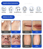 FAC 5000W 2 IN 1 Professional 4 Wave 808 Diode Laser Permanent Painless Hair Removal Picosecond Laser Tattoo Removal Machine