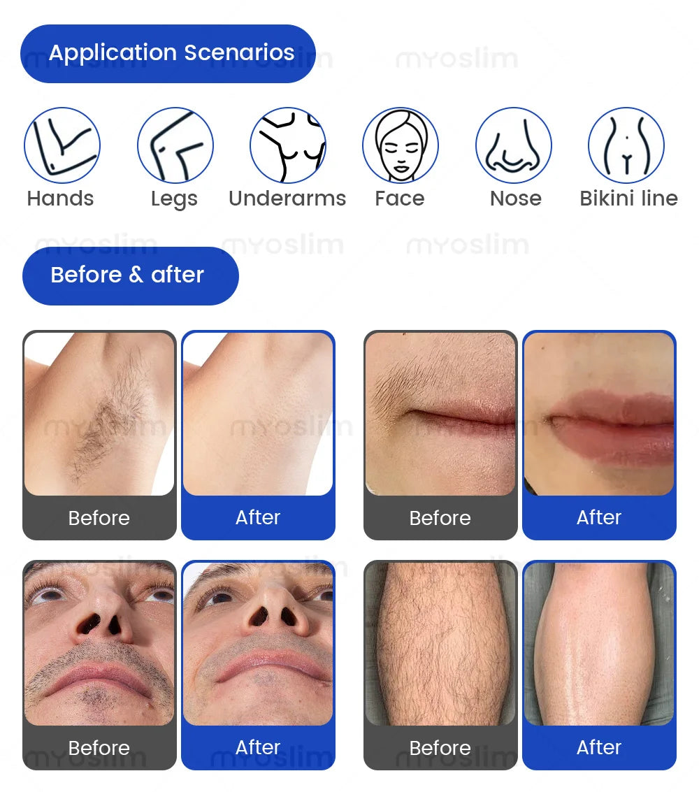 FAC 5000W 2 IN 1 Professional 4 Wave 808 Diode Laser Permanent Painless Hair Removal Picosecond Laser Tattoo Removal Machine