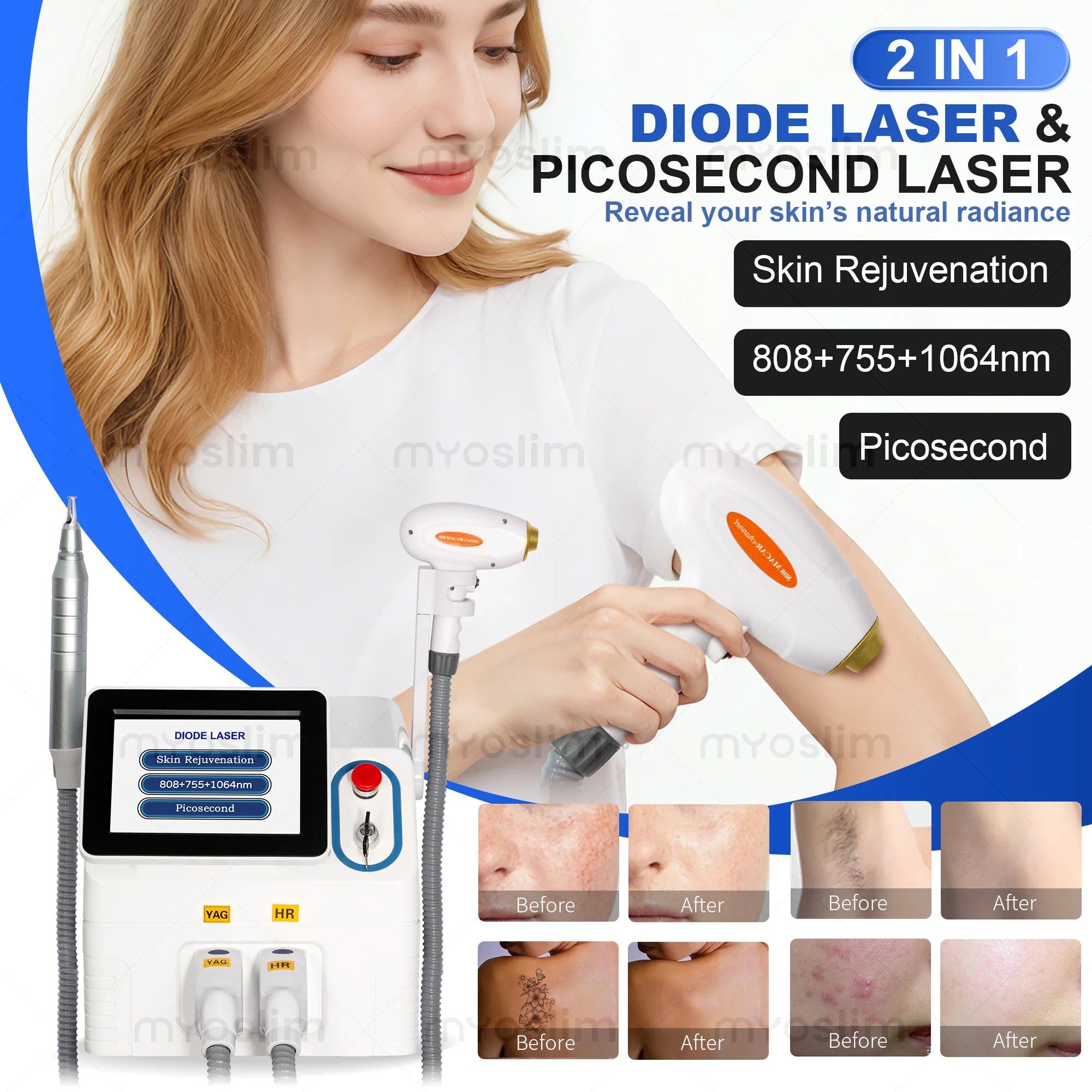 2IN1 Picosecond 808nm Diode Laser Hair Removal Machine Alexandrit 5000W Permanent Painless Tattoo Cooling Body Removal Equipment