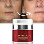 Instant Retinol Cream Wrinkle Remover Firming Lifting Anti Aging Fade Fine Lines Moisturizing Whitening Korea Repair Skin Care