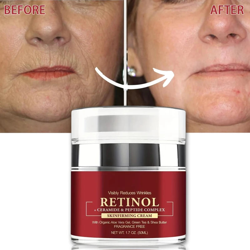 Instant Retinol Cream Wrinkle Remover Firming Lifting Anti Aging Fade Fine Lines Moisturizing Whitening Korea Repair Skin Care Main image