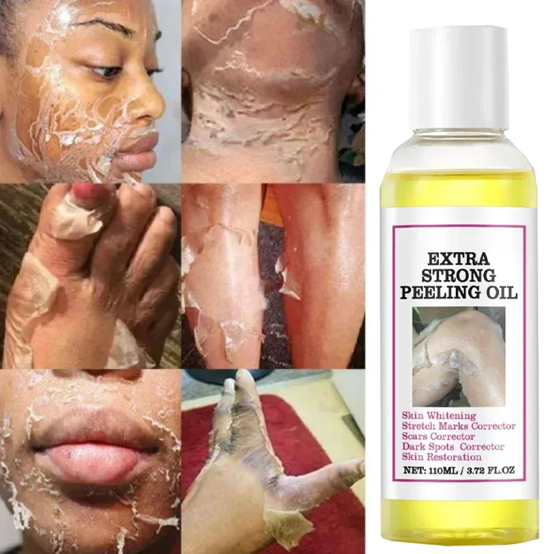 Yellow Peeling Lotion Oil 100% Organic Bleaching Dark Skin Exfoliating Whitening Nourishing Hyaluronic Acid Moisturiz Body Scrub Secondary image