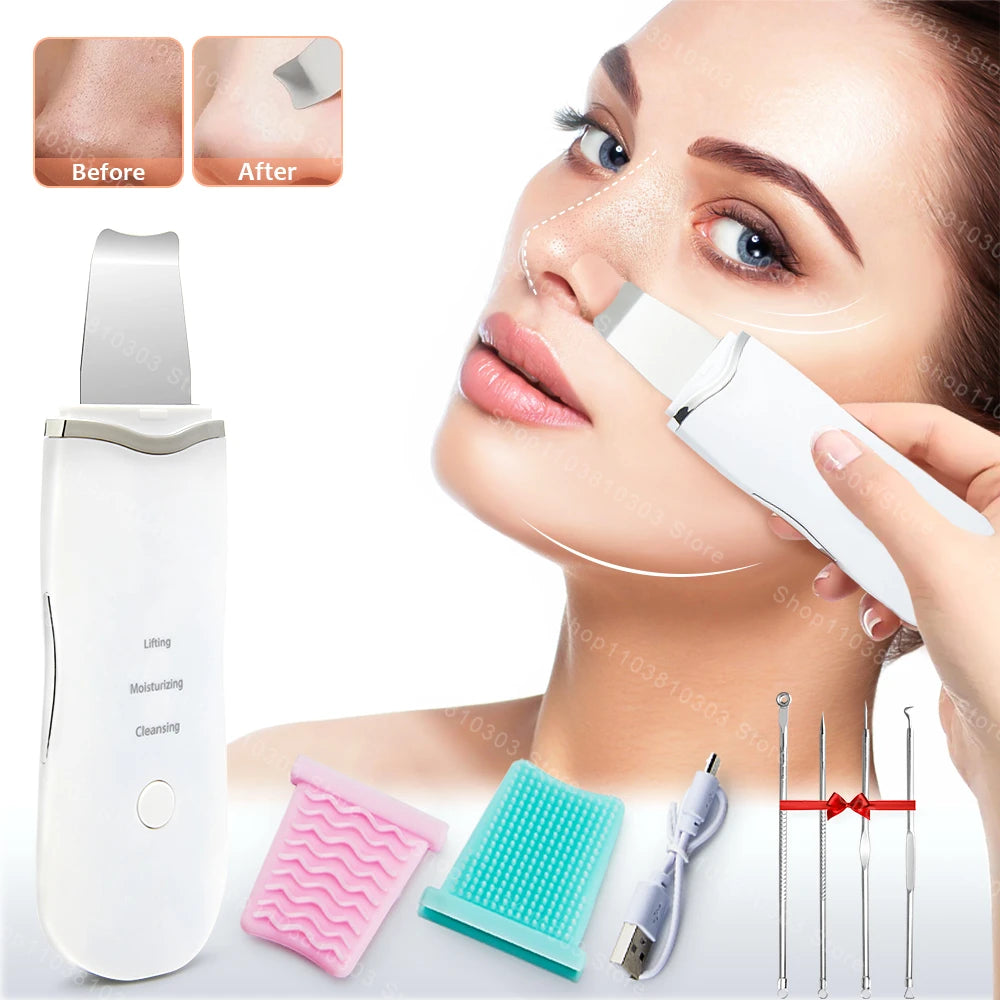 Electric Ultrasonic Skin Scrubber Vibration Face Spatula Peeling Blackhead Remover Facial Lifting Cleansing Ultrasonic Skin Care Main image