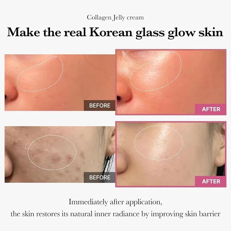 100g Jelly Face Cream Collagen Soft SPA Nourishing Moisturize Face Shrinks Pores Remove Comedones Jelly Essence Korean Skin Care Secondary image