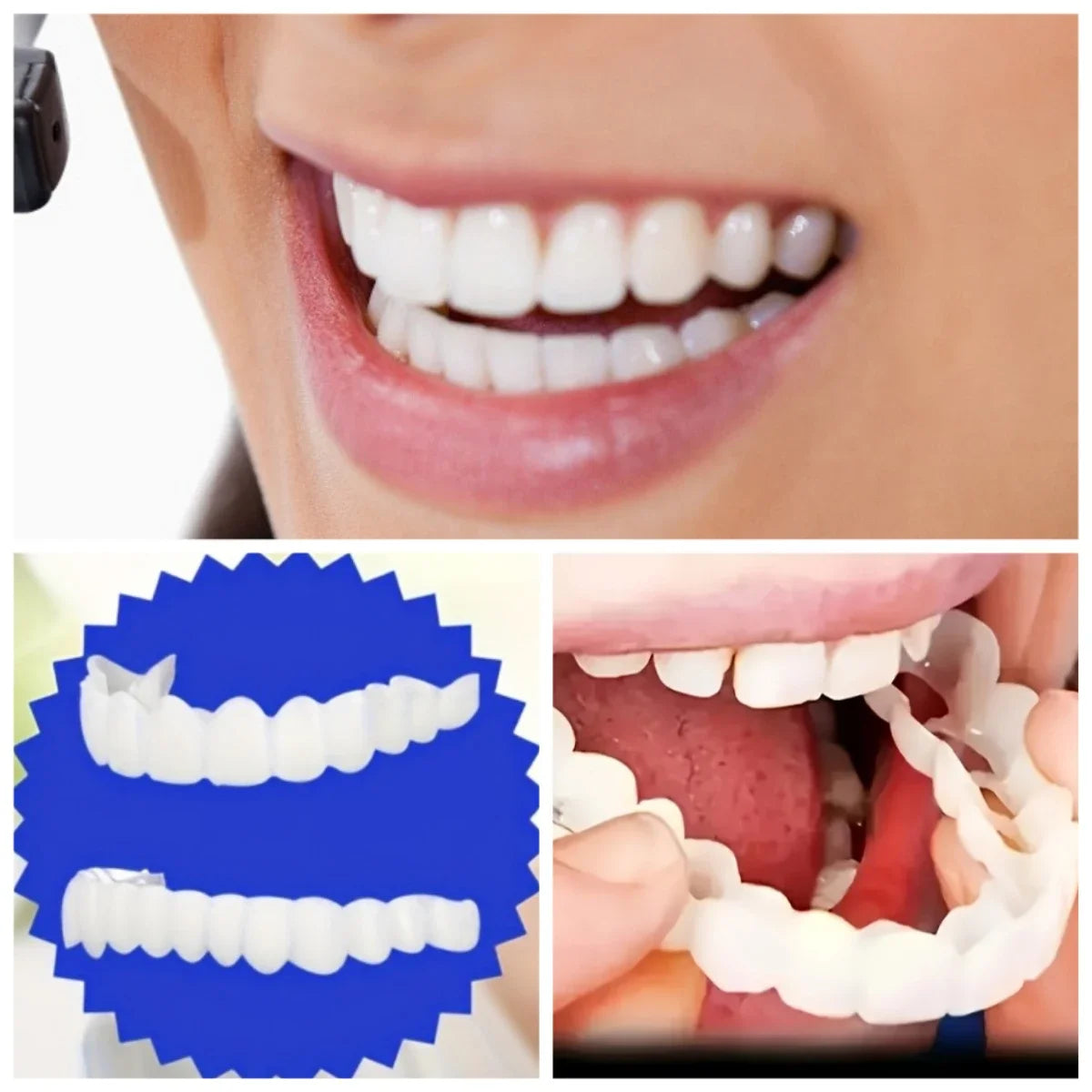 2 Sets Invisible Fake Teeth Kit, 2 Upper 2 Lower Veneers with Brush and Storage Box for Men Women