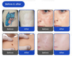 FAC 5000W 2 IN 1 Professional 4 Wave 808 Diode Laser Permanent Painless Hair Removal Picosecond Laser Tattoo Removal Machine