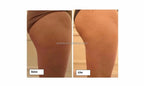 NEW Portable Emsnova Machine Pelvic Floor Training Body Slimming Electrical Muscle Stimulation Non Invasive Professional Be